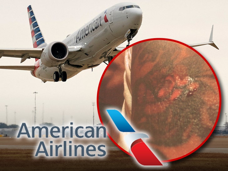 American Airlines Sued By Passenger Over Scalding Hot Coffee Incident
